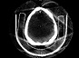 De la tomographie du corps humain à celle du proton