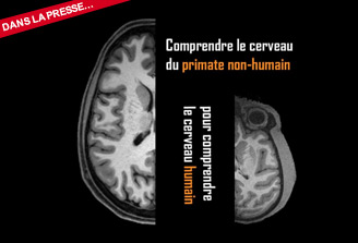 Une base de données internationale pour mutualiser l’imagerie cérébrale de primates