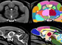 Révision d'un dogme sur l’évolution du cerveau chez les primates